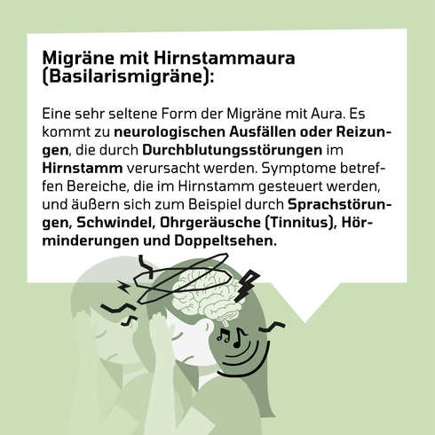 Grafik Migränearten: Basilarismigräne Die Grafik erklärt die Basilarismigräne oder auch Migräne mit Hirnstammaura